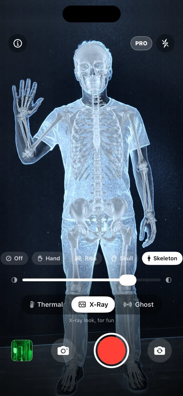X-ray camera effect: a whole skeleton laid over a person